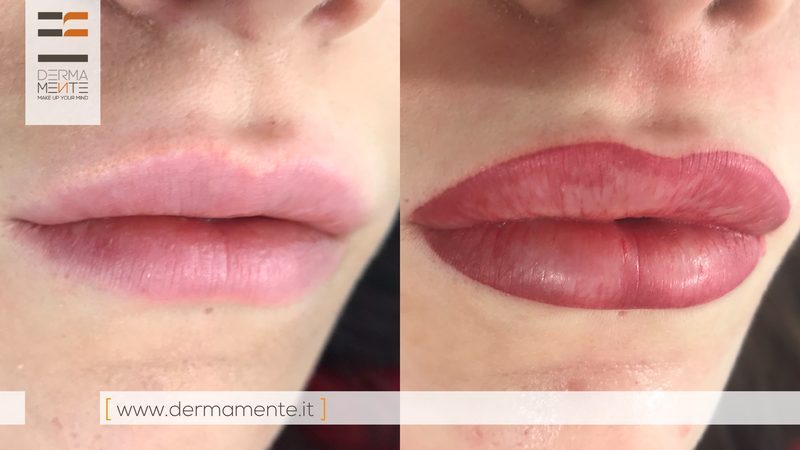 Contorno labbra permanente Roma