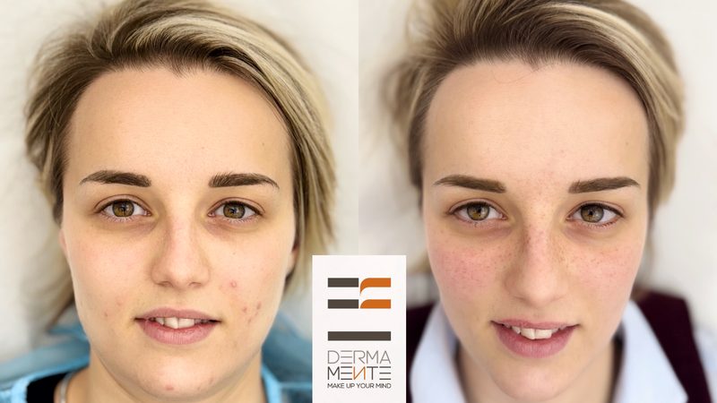 Areola mammaria tatuaggio paramedicale Roma